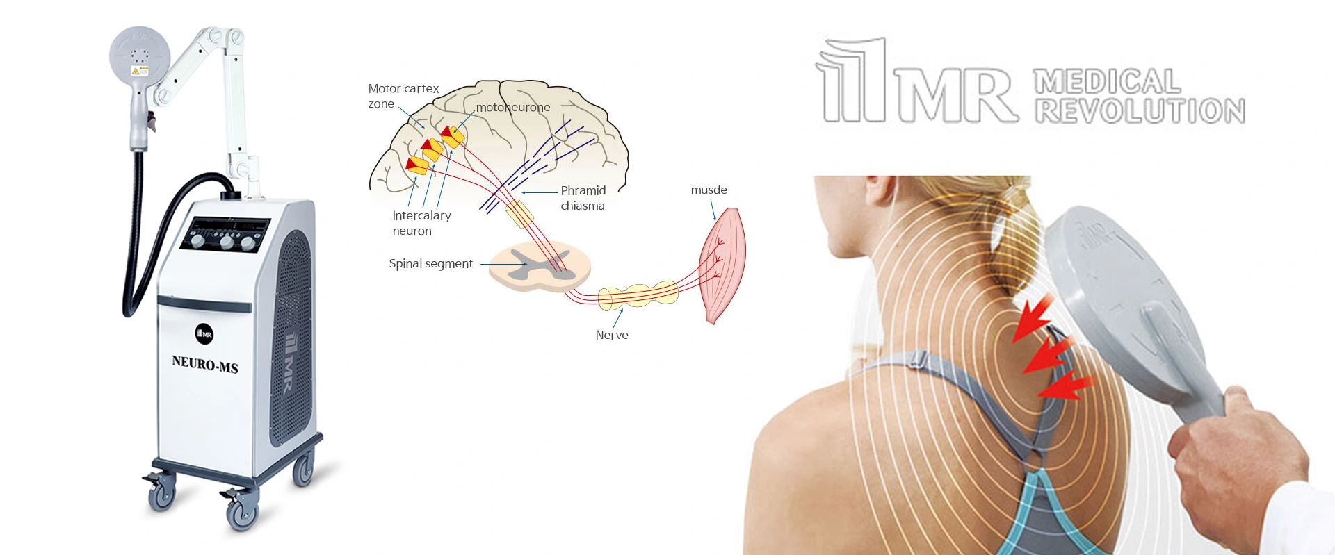 บริษัทจัดจำหน่ายเครื่อง PMS
